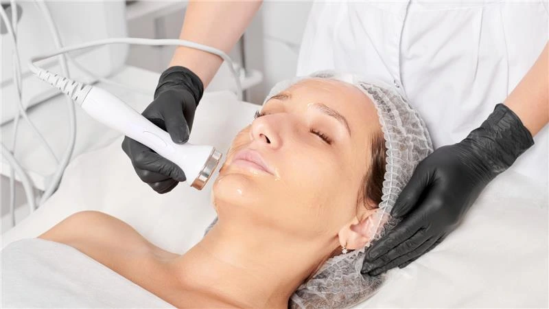 Skin tightening laser treatment